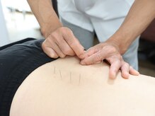 こさつ鍼灸治療院/