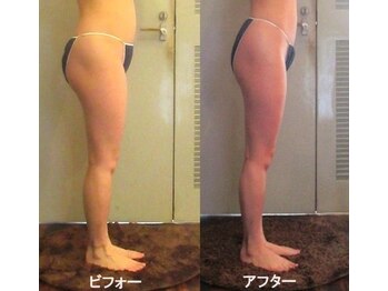 痩身 セル脂肪専門 スタイルデザイン/ヒップアップ→腰位置高く→脚長