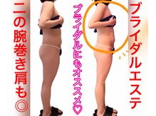 アールズ スリム(R's slim)/ブライダル痩身ならお任せ！！