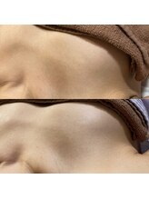 ララルアナ(Lara luana)/30代の美胸ケア