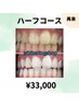 【効果しっかり実感したい方◎】美白セルフホワイトニング40分×5回 ¥33,000