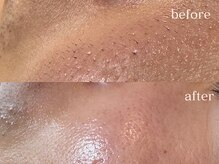 ハダケア(HADA CARE)/フェイスワックス