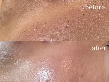 ハダケア(HADA CARE)/フェイスワックス