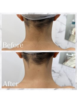 スカイカット(SKY CUT)/襟足シェービングでスッキリ◎