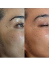 こうぞう整体院/美容鍼×ピーリング