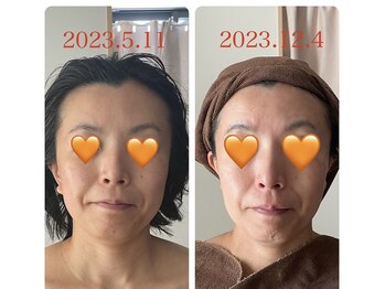 ノレーヴ(NOS REVES)/小顔