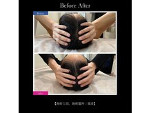 フルオール(FRUOR)の雰囲気（眼精疲労・脳疲労・睡眠不足・自律神経の乱れを整えます）