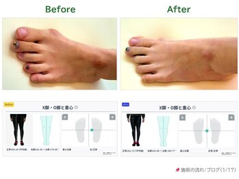 サロンラグナ(Salon Laguna)/【身体ケア】足部調整