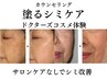 New【塗るシミケア使用感体験】サロンに通えない方/肌診断機付/￥5000