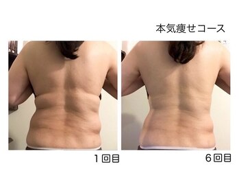 プライベートサロンイムエ(Private Salon IMME.)の写真/熟練のハンドテクニックで、理想のボディラインへ！痩せやすいカラダ作りをサポート◎