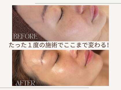 リュール 戸越銀座(Lueur)の写真