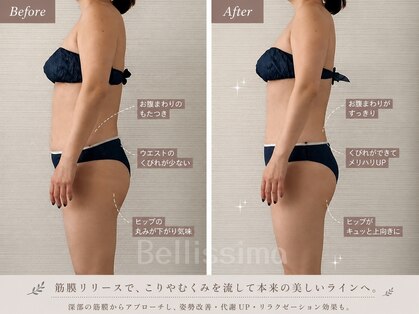 ベリッシマ 北仙台(Bellissima)の写真