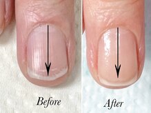 トゥインクリーネイルサロン(Twinkly Nail Salon)/【最強のネイルケア】1回お試し