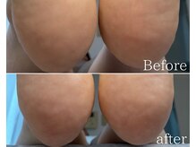 カシェット 広島店(Cachette)/50代女性☆足裏角質ケア90分