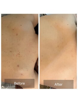 ビビ(VIVI)/ブライダルにおすすめ☆