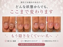 アウェイク ネイル(Awake Nail)