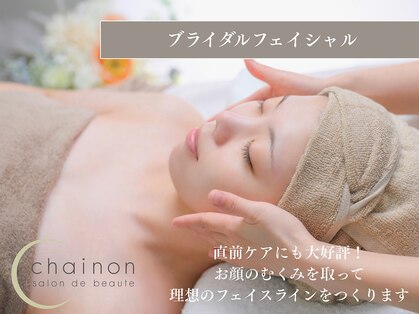 シェノン(chainon)の写真