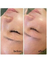 ラシック(Rachic)/細胞復元パック☆