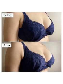 アンシャンテ(ENCHANTER)/光バストアップ