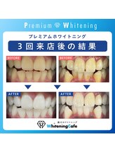ホワイトニングカフェ イオン新潟青山店(WhiteningCafe)/★★歯科提携★★プレミアムWC
