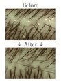 クリアラボ 錦糸町(Clear Lab) 頭皮洗浄【Before→After】