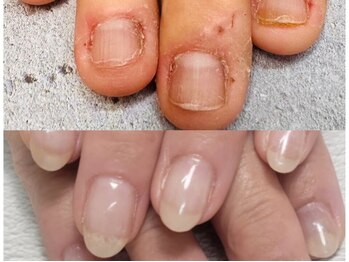 グレースレディ/寄り添って改善を目指します