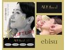 糸deリフトアップフェイシャル90min　￥24,750 → ￥18,000