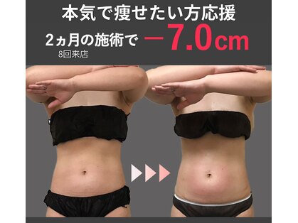 蓮子の夢の写真