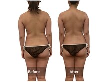 ベンザイ 梅田店(BENZAI)/背中にバストが流れる