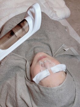 ハリサク/施術風景