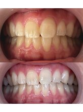 コアルナ センター北店(Coalna)/歯科提携・セルフホワイトニング