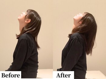 ソレア(Solea)/首こり改善1回目