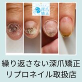 ブルームブルーム(BLOOMブルーム)