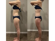 タイコボディラボ 桜山店(TAICO BODY LABO)/骨盤矯正＋EMS