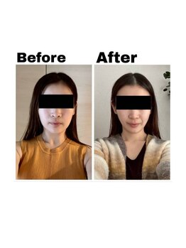 ルル(Ruru)/韓国コルギ/10回目