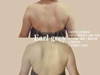 エステティックサロン アールグレー 名古屋駅店/背中2クールの変化/キャビハイパ