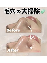 ビレボ マエバシ(BEREVO maebashi)/Before After