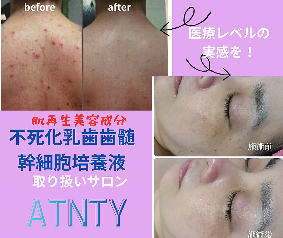 ピュアビューティー(Pure Beauty)｜ホットペッパービューティー