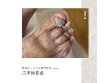 オツメ 静岡(O-tume)の雰囲気（爪のトラブルは何でもご相談下さい。）