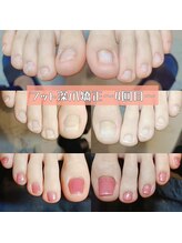 マニエネイル(mani e nail)/ 爪の状態に合わせた深爪矯正