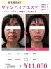 【話題のヴァンパイアマスク】たるみ・シワ改善で若見え肌へ¥19,200→¥13,000