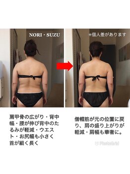 ノリスズ(NORI SUZU)/僧帽筋・反り腰・肩甲骨・背中幅