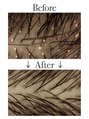 クリアラボ 錦糸町(Clear Lab) 頭皮洗浄【Before→After】
