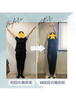 ラクリエ 東加古川院(La Creer)/お客様ビフォーアフター