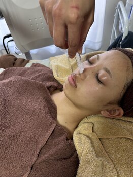 リコニコ(CErico2co)の写真/【至高の毛穴ケアで皮脂詰まりを改善◎】美容成分を肌にふんだんに入れ込み、ふっくら毛穴レスな美肌に♪