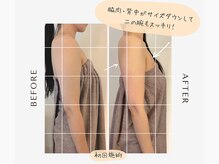 フィル 名駅店(fil)/1回施術でもここまで変わる！