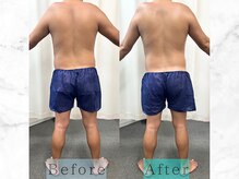 パラディ(PARADIS)/ボディコルギ