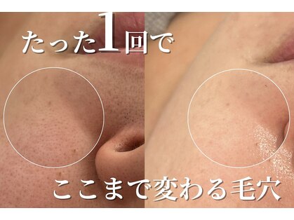 エトレ(etre)の写真