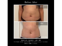 フルオール(FRUOR)の雰囲気（冷え・むくみ・代謝低下を整え、痩せやすく疲れにくい身体へ）