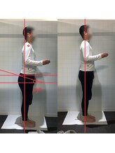ラグ整体院(rag整体院)/姿勢改善20代　結果重視！